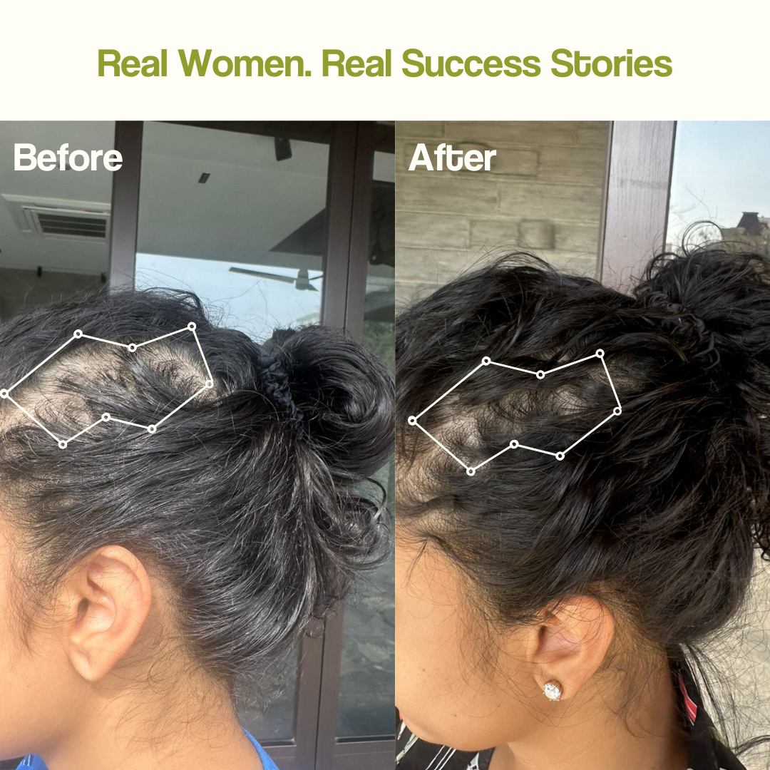Hair Revive Kit