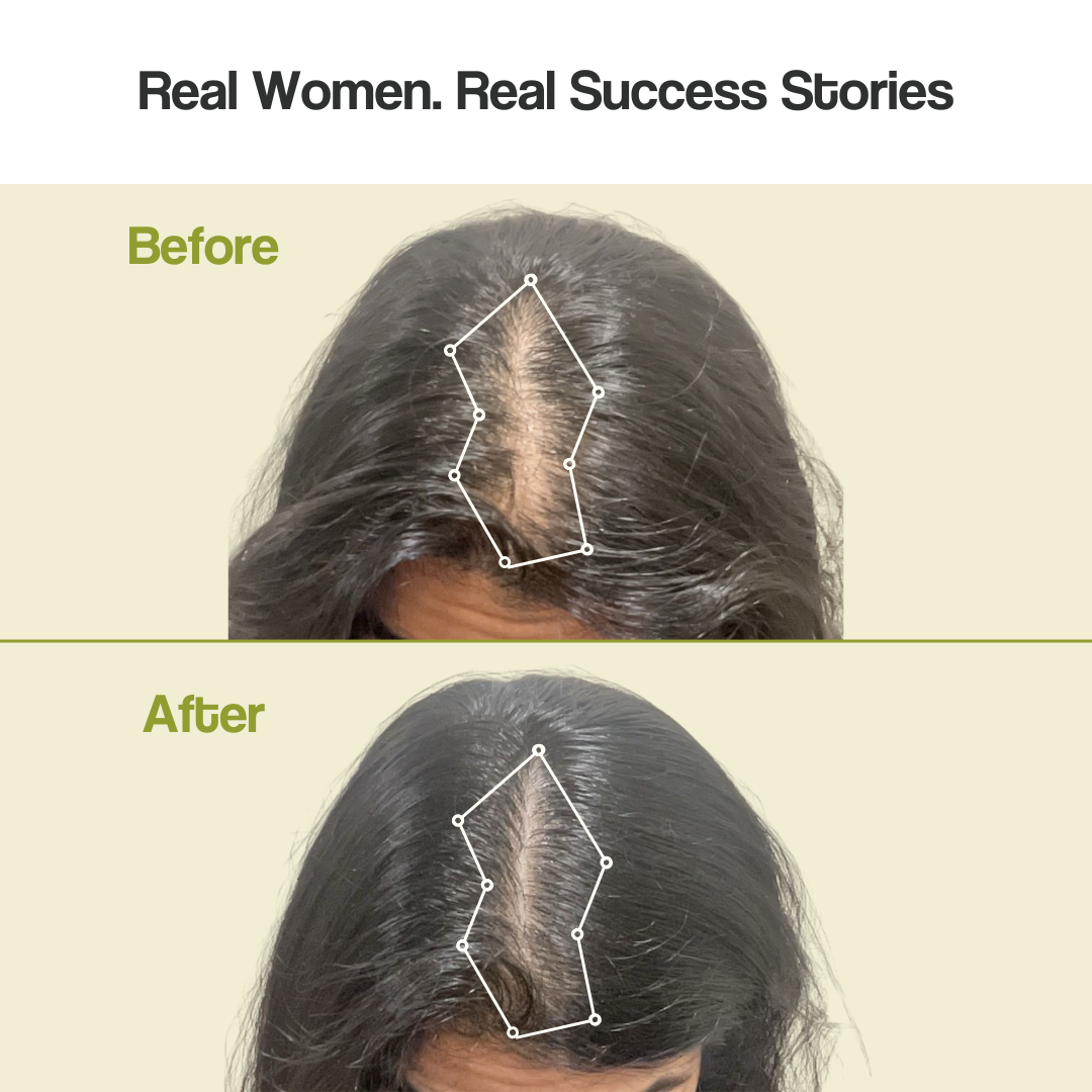 Hair Revive Kit